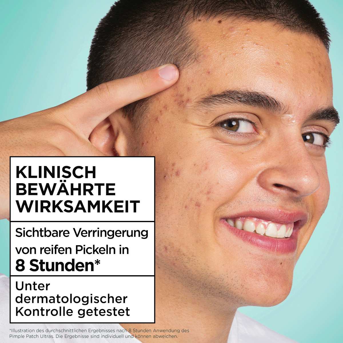 Garnier Skin Active Anti-Pimple Patches Invisible - view 4