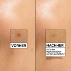 Garnier SkinActive Serum Glow Booster Vitamin C Anti-Dark-Spots, 30 ml