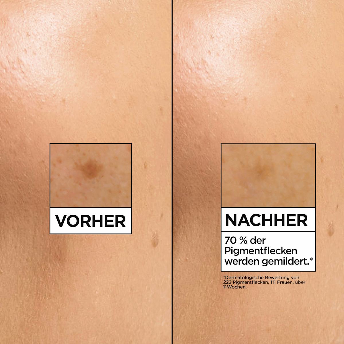 Garnier SkinActive Serum Glow Booster Vitamin C Anti-Dark-Spots, 30 ml
