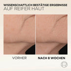 L'ORÉAL PARiS Age Perfect Micro-Collagen Serum, 30 ml